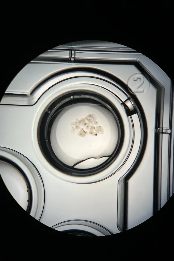 IVF